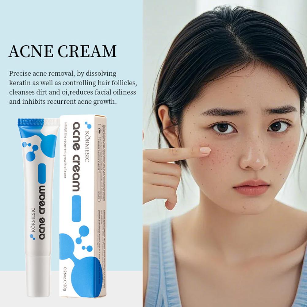 20% アゼライン酸配合のニキビ除去クリーム、さっぱりとした - Luxury Skincare Brands のレビューと価格